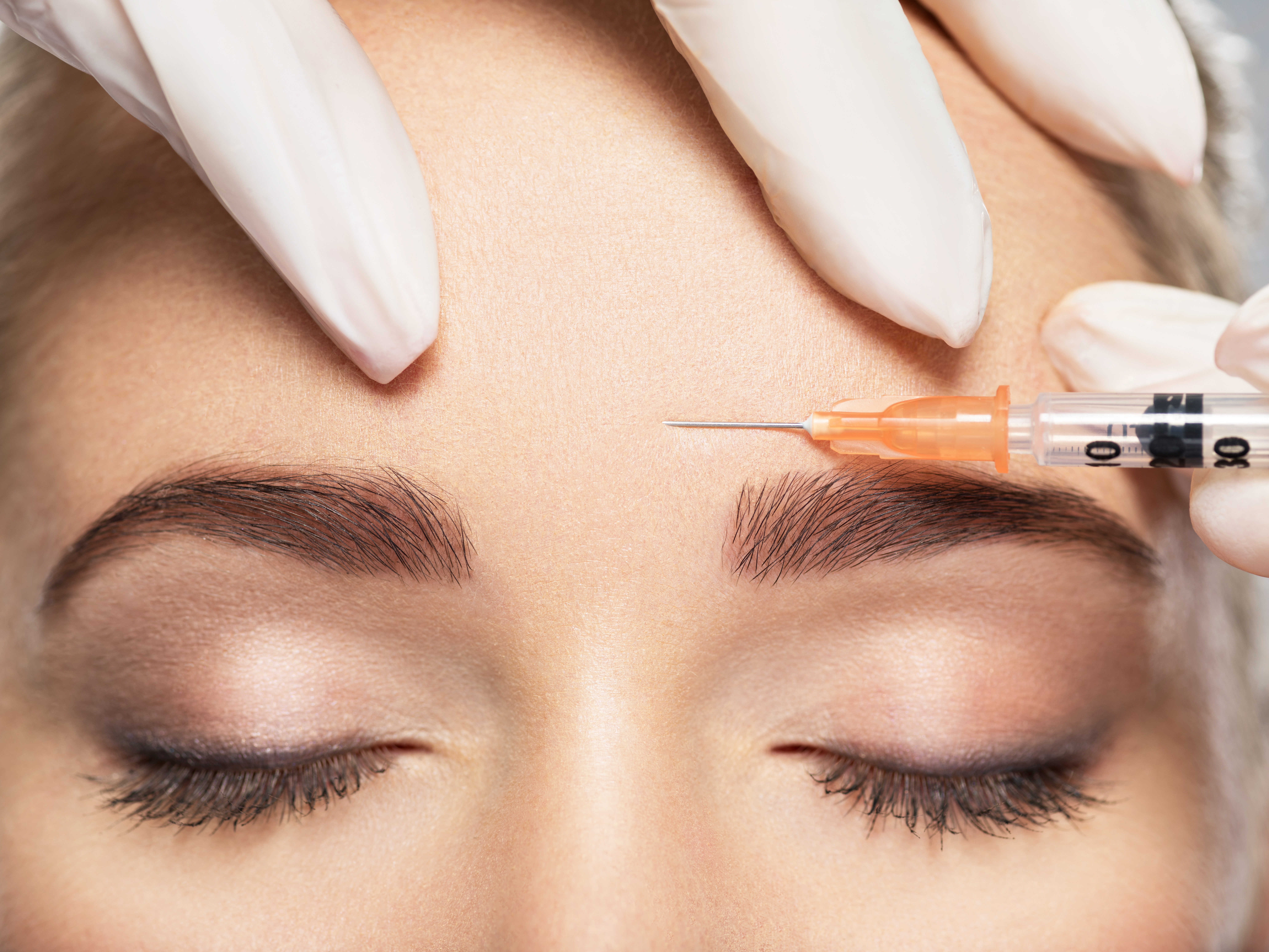 Botox Ulm Kosten